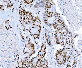 SP1 Mouse Monoclonal Antibody