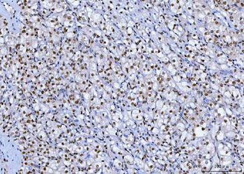 SP1 Mouse Monoclonal Antibody