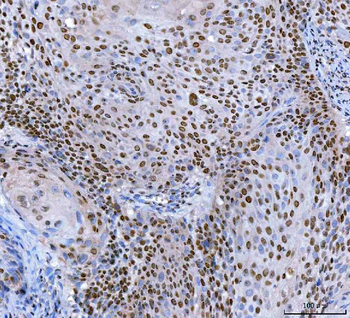 SP1 Mouse Monoclonal Antibody