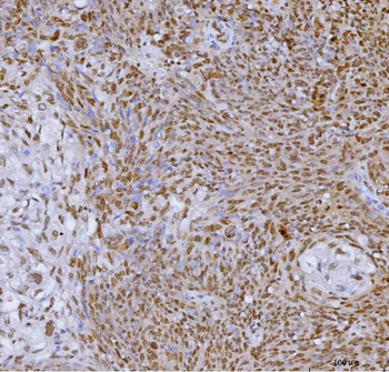 SP1 Mouse Monoclonal Antibody