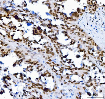 SP1 Mouse Monoclonal Antibody
