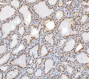 SP1 Mouse Monoclonal Antibody