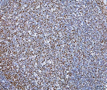 SP1 Mouse Monoclonal Antibody