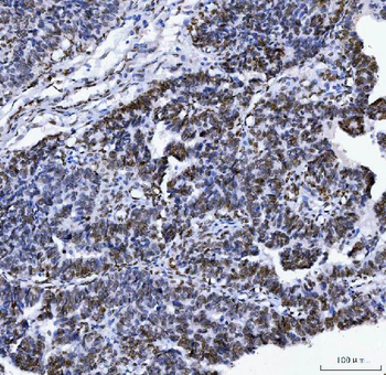Lamin A+C/LMNA Mouse Monoclonal Antibody