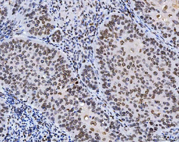 Lamin A+C/LMNA Mouse Monoclonal Antibody