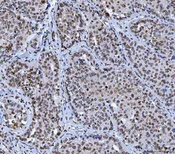 Lamin A+C/LMNA Mouse Monoclonal Antibody