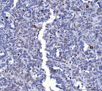 Lamin A+C/LMNA Mouse Monoclonal Antibody