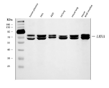 Lamin A+C/LMNA Mouse Monoclonal Antibody