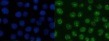 XRCC1 Mouse Monoclonal Antibody
