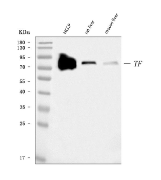 Transferrin/TF Mouse Monoclonal Antibody