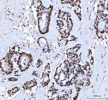 CTBP2 Mouse Monoclonal Antibody