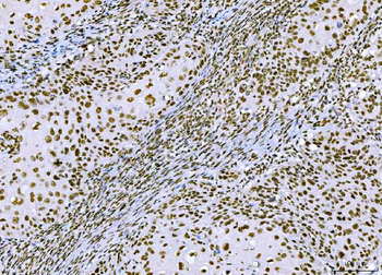 CTBP2 Mouse Monoclonal Antibody