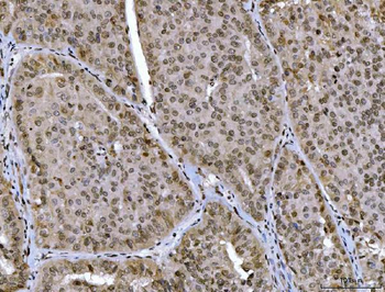 CTBP2 Mouse Monoclonal Antibody