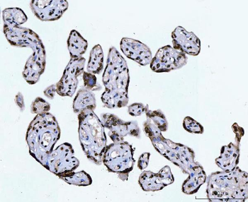 CTBP2 Mouse Monoclonal Antibody