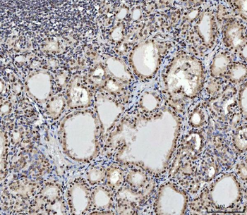 CTBP2 Mouse Monoclonal Antibody