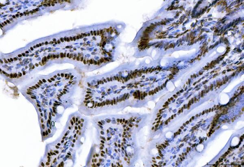 CTBP2 Mouse Monoclonal Antibody