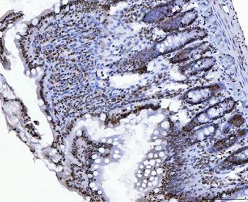 CTBP2 Mouse Monoclonal Antibody