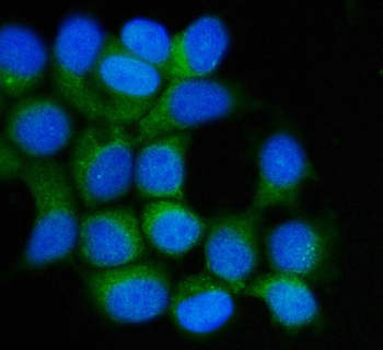 Hsp90 beta/HSP90AB1 Mouse Monoclonal Antibody