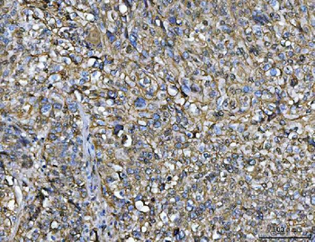 Annexin A1/ANXA1 Mouse Monoclonal Antibody