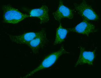 PARK7/DJ1 Mouse Monoclonal Antibody