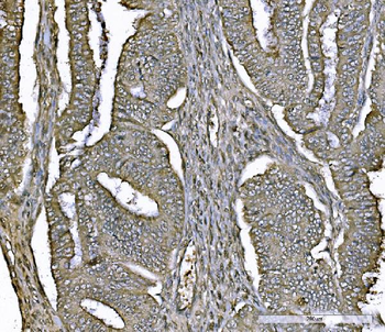 PARK7/DJ1 Mouse Monoclonal Antibody