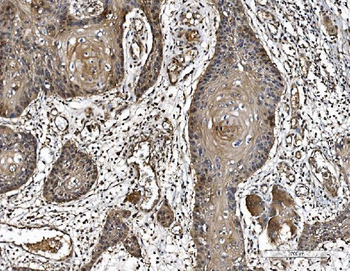 PARK7/DJ1 Mouse Monoclonal Antibody