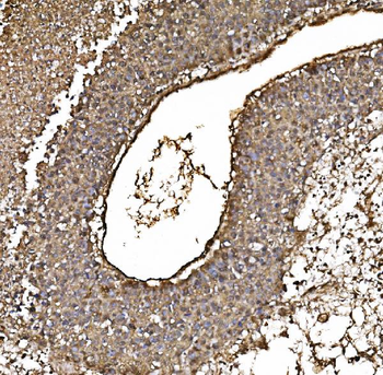 PARK7/DJ1 Mouse Monoclonal Antibody