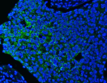 PITPNB Rabbit Polyclonal Antibody