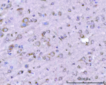 PITPNB Rabbit Polyclonal Antibody