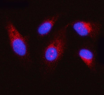 OXSM Rabbit Polyclonal Antibody