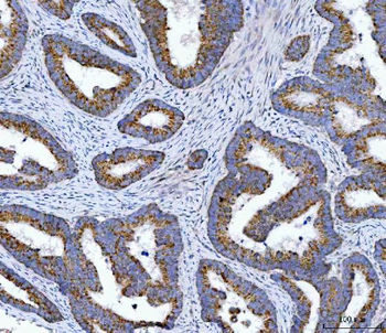 OXSM Rabbit Polyclonal Antibody
