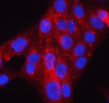 PACSIN2 Rabbit Polyclonal Antibody