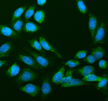 RPS14 Rabbit Polyclonal Antibody