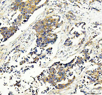 RPS14 Rabbit Polyclonal Antibody