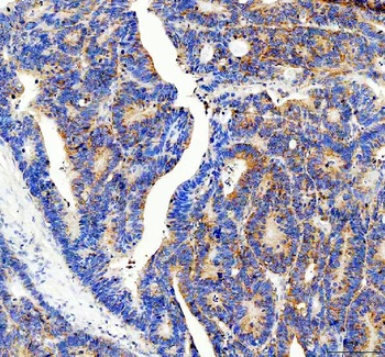 RPS14 Rabbit Polyclonal Antibody