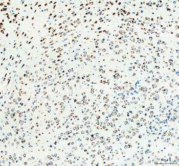 RPS14 Rabbit Polyclonal Antibody