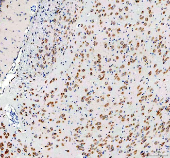 RPS14 Rabbit Polyclonal Antibody