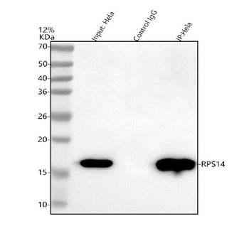 RPS14 Rabbit Polyclonal Antibody