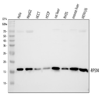 RPS14 Rabbit Polyclonal Antibody
