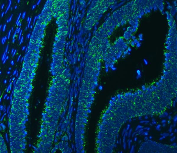 SSBP1 Rabbit Polyclonal Antibody