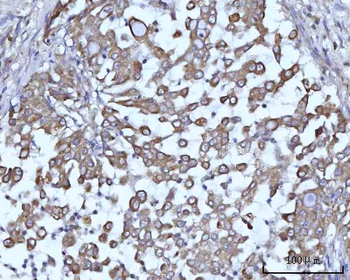 SSBP1 Rabbit Polyclonal Antibody