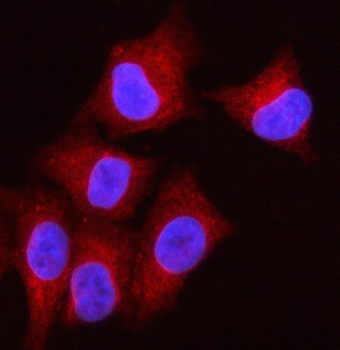 OLAH Rabbit Polyclonal Antibody