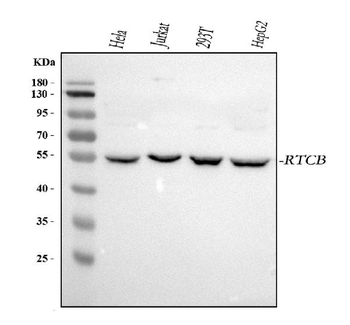 RTCB Rabbit Polyclonal Antibody