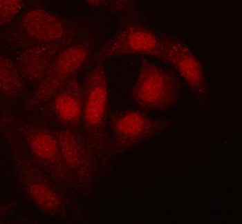 RTCB Rabbit Polyclonal Antibody