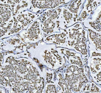 RTCB Rabbit Polyclonal Antibody