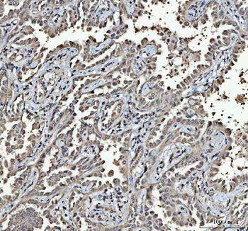 RTCB Rabbit Polyclonal Antibody