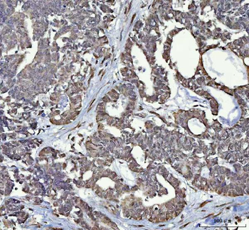 RTCB Rabbit Polyclonal Antibody
