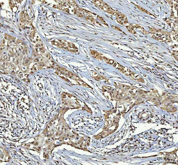 RTCB Rabbit Polyclonal Antibody