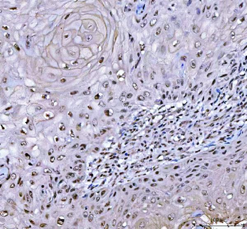 RTCB Rabbit Polyclonal Antibody