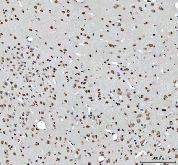 RTCB Rabbit Polyclonal Antibody